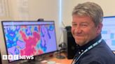 Peterborough medics begin AI breast cancer analysis trial