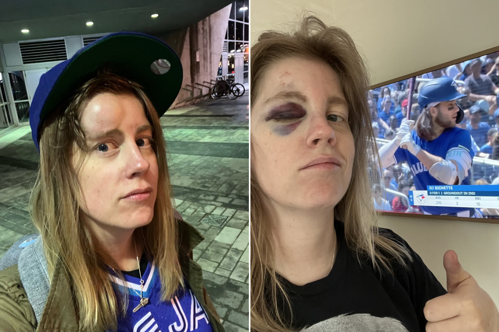 A fan hit by a foul ball stayed through the 9th. Now she’s on a baseball card.