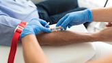 CDC: All Adults Should Be Tested for Hepatitis B at Least Once in Their Lifetime