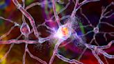 Científicos descubren neuronas que se iluminan al ver imágenes de alimentos