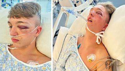 TRNSMT staff blasted after teen battered into coma as they "stood and watched"