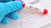 Sherlock starts clinical trial for rapid OTC diagnostics for STIs