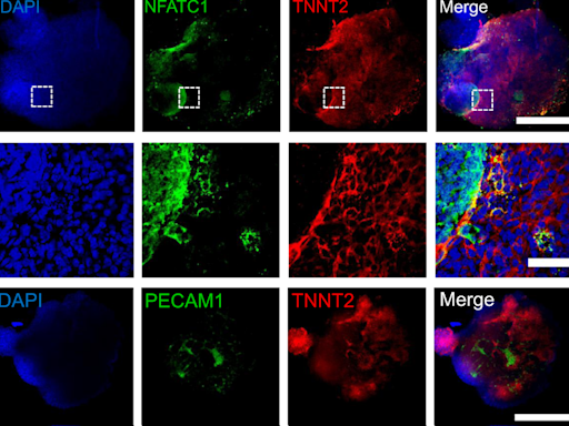 Engineering mini human hearts to study pregnancy complications and birth defects