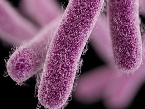 Shigella outbreak hits Calgary shelters and encampments, sending 16 to hospital | CBC News