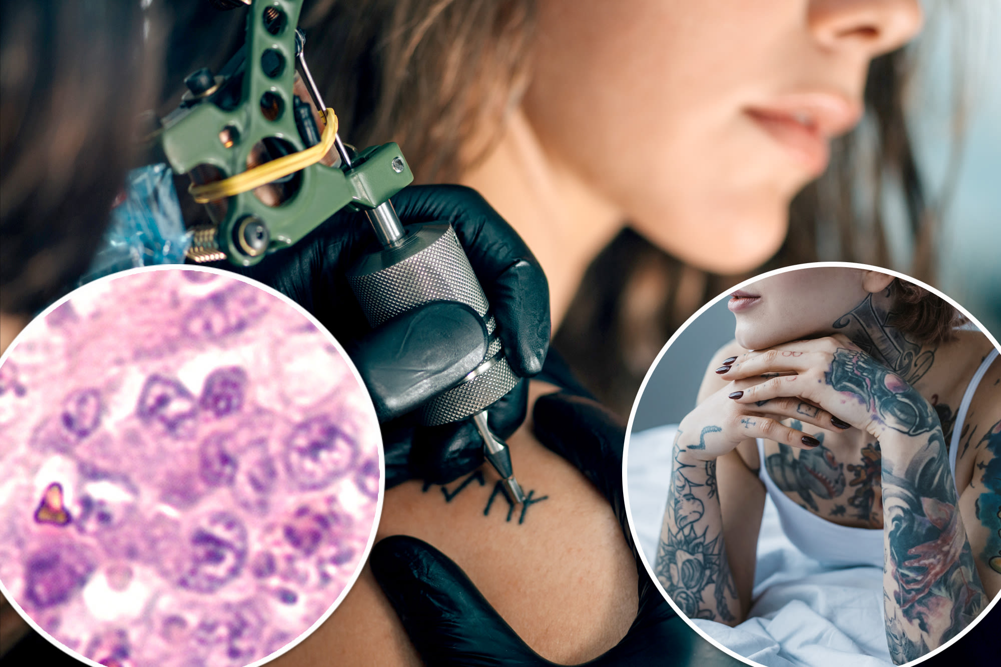 Possible link between tattoos and lymphoma revealed in new study