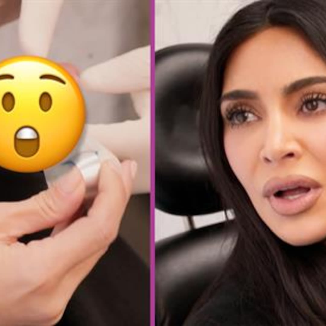 See Kim Kardashian's Shocking Hand Injury That Was "Worse Than Childbirth" - E! Online