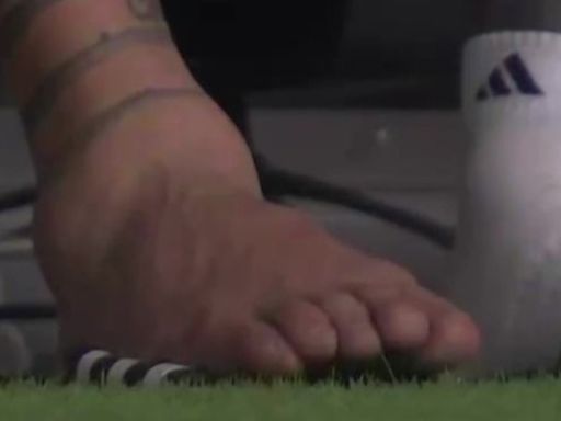 Messi se lesionó y salió en llanto: así le quedó su tobillo