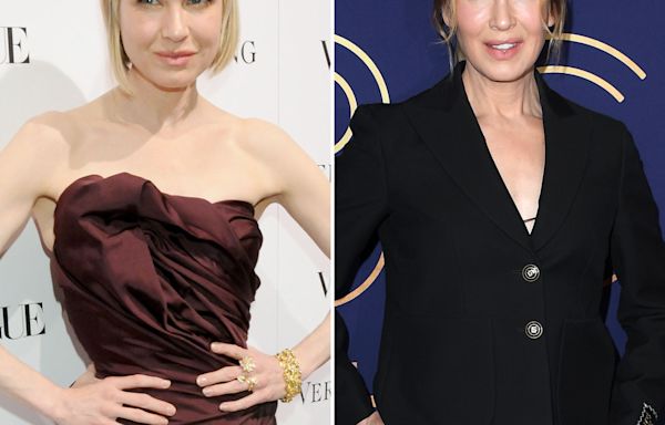 Renee Zellweger’s Shocking Face Transformation: Her Eyes Look ‘Catlike,’ Says Source