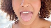 From blue to black, purple to green - what the COLOUR of your tongue means