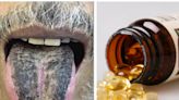 From a man with a black, hairy tongue to a vitamin D overdose, here are 3 fascinating medical cases from 2022