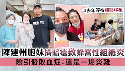 陳建州胞妹擠暗瘡致蜂窩性組織炎 險引發敗血症：這是一場災難