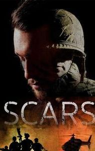 Scars