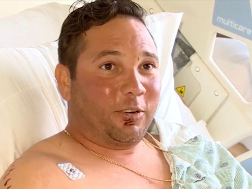 Fisherman ‘lucky to be alive’ after being attacked by bull shark in front of his children