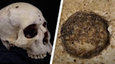 ‘Extraordinary’ Egyptian skull shows medical attempts to treat cancer more than 4,000 years ago