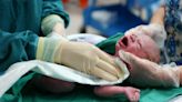Hospitals record newborn babies’ ‘gender identity’ rather than their sex