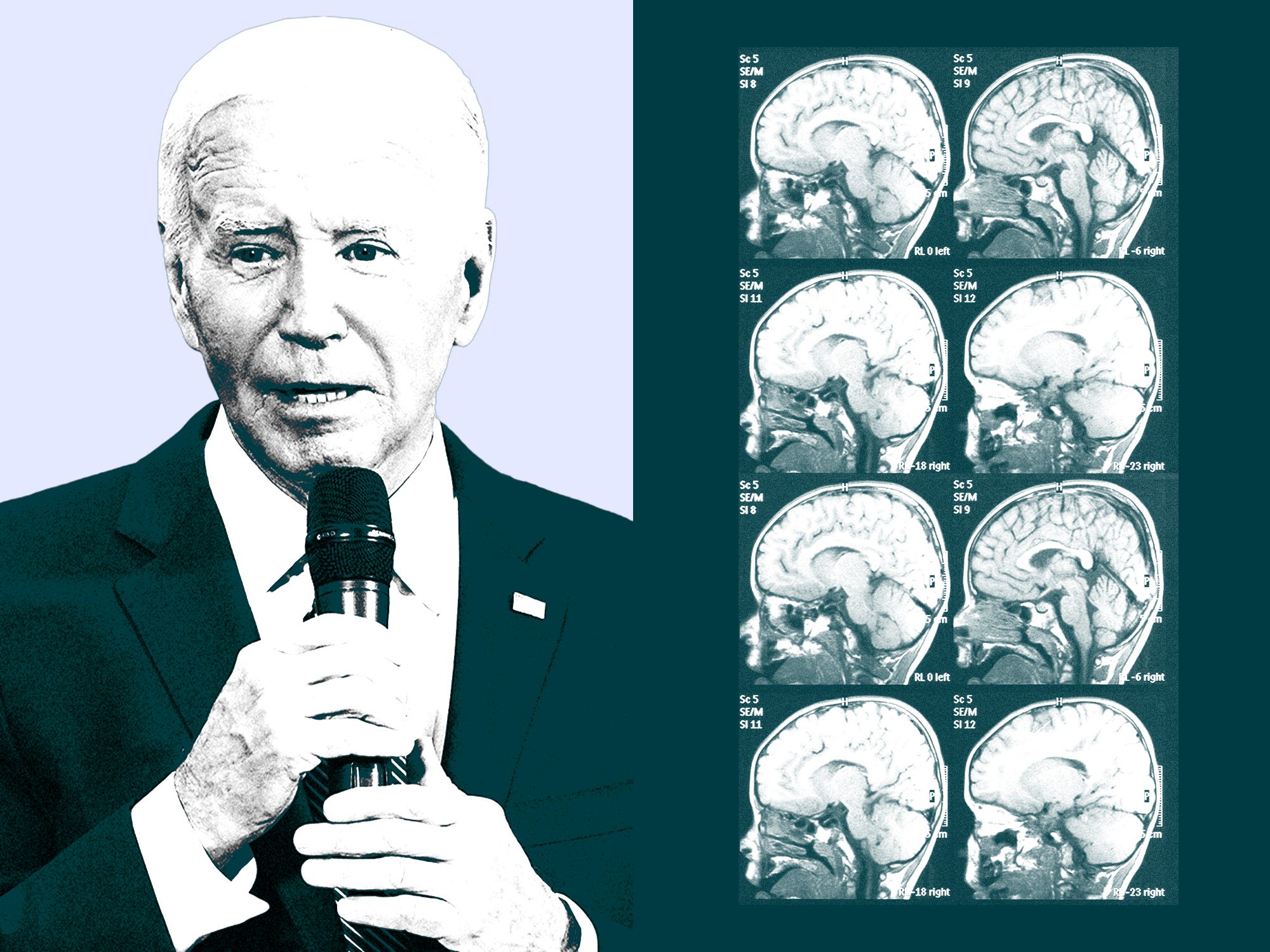 A brain expert explains the cognitive test used to assess a president's mental fitness. It's not easy.