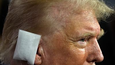 Trump is back out in the spotlight for the first time after his assassination attempt, and he's wearing a massive rectangular bandage over his ear