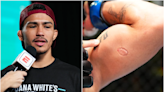 Igor Severino suspended nine months, fined $2K by NAC for UFC biting incident