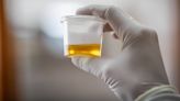 Urine sample study finds industrial toxin in adolescents: 'There is a lot of exposure'