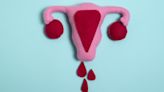 ¿Los genes pueden influir en la menstruación? Esto halló estudio internacional