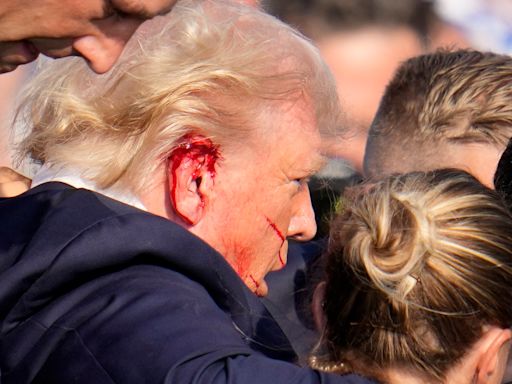 Trump’s ear was struck by bullet in assassination attempt, FBI confirms