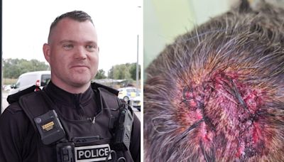 'I thought I was going to die': Police release images of officer's injuries