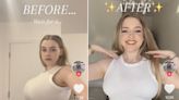 Women on TikTok are sharing their breast reduction stories and how it's changed their lives: 'Best decision'