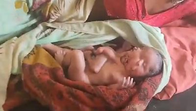 VIDEO: Woman Gives Birth To Baby With 2 Faces, 4 Legs & 4 Arms In UP's Sitapur; Newborn Dies Within Few Hours