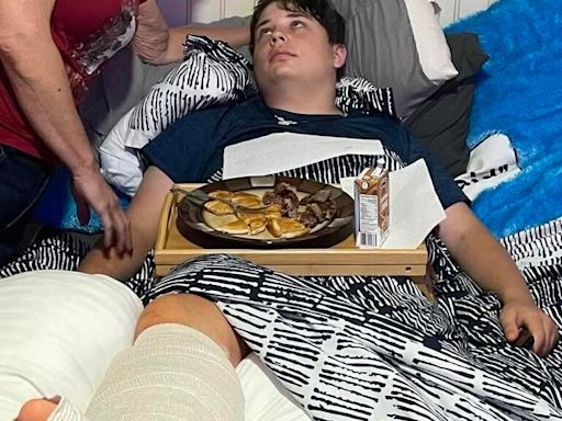 Cabell County teen home, recovering after NC shark attack