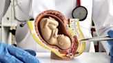 Útero artificial para salvar la vida de bebés prematuros | Teletica