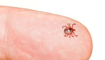 Tick-borne Powassan virus reported in Massachusetts: ‘The virus can invade the central nervous system’