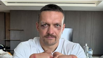 Don’t Be fooled – Oleksandr Usyk Will have his hands full In A tyson fury Rematch