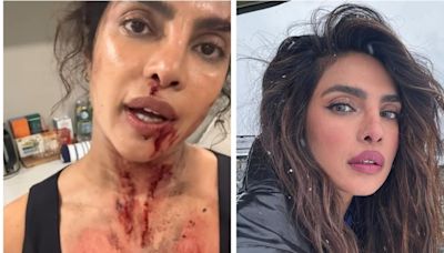 Priyanka Chopra drops her look covered in blood and bruises from The Bluff: ‘Action is really glamorous’