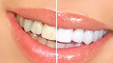 Hate Wearing Whitening Strips? Check Out This Teeth Whitening Pen