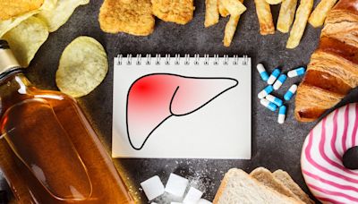 5 Thumbrules That Can Reverse Fatty Liver Naturally