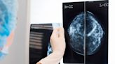 Mammograms Should Start at Age 40, New Guidelines Say