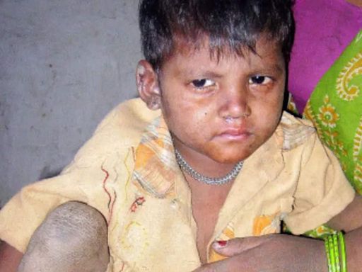 India's future being gutted: Congress slams govt over child malnutrition - The Economic Times