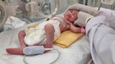 A Palestinian baby in Gaza is born an orphan in an urgent cesarean section after an Israeli strike