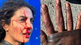 Priyanka Chopra Drops Pics Of Bloody Face, Injured Hands From The Bluff Sets. Fans Worried