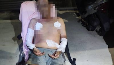 台南55歲男放火燒自家宮廟 全身燒燙傷命危