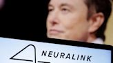 馬斯克Neuralink首例病患 晶片出問題 腦部數據減少