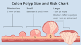 Colon Polyp Size Chart to Gauge Risk