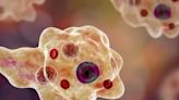 14-year-old boy recovers from amoebic meningoencephalitis in Kerala - ET HealthWorld