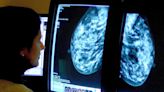 Breast cancer cells ‘evade treatment by hibernating’