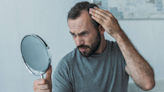 5 natural remedies that will help reverse hair loss