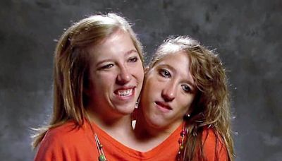 Conjoined twin Abby Hensel is now married