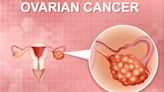 Demystifying Ovarian Cancer: Causes, Symptoms, Treatment, And Prevention