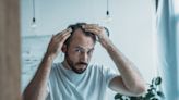 One in 10 men worried their hairline will end their relationship