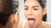 Stick out your tongue to check 'if you should be drinking coffee', doctor says