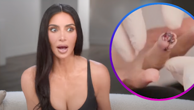 Kim Kardashian Slices Part of Finger: 'More Painful Than Childbirth'